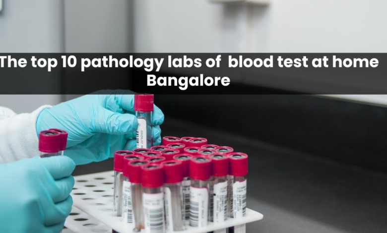 The top 10 pathology labs of blood test at home Bangalore