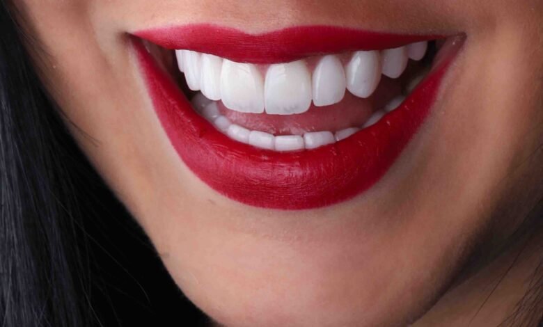 Best Lip Filler Treatment in Dubai
