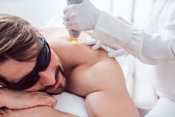 men's laser hair removal in Abu Dhabi