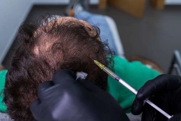 PRP Hair Treatment in Abu Dhabi