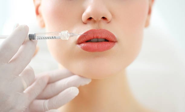 Lip fillers Abu Dhabi