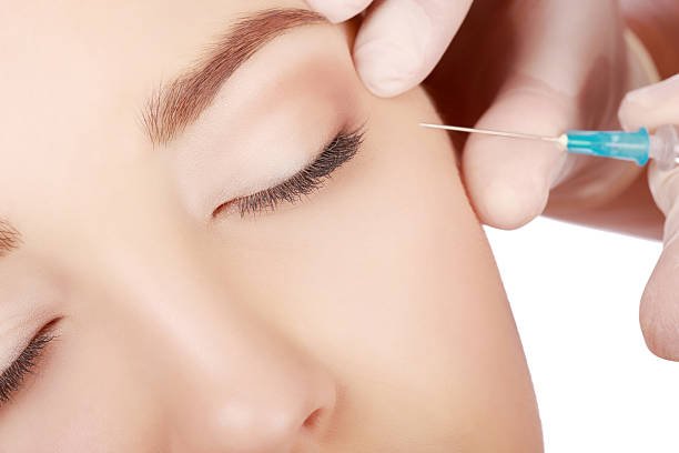 Dermal Fillers Injections