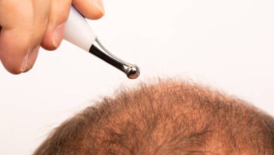 Scalp Micropigmentation in Abu Dhabi