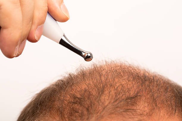 Scalp Micropigmentation in Abu Dhabi