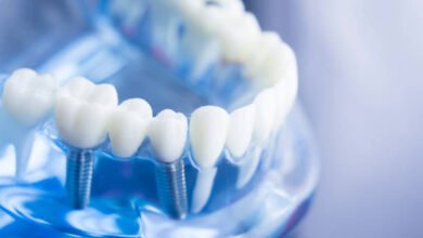 Root Canal Treatment Cost in Abu Dhabi