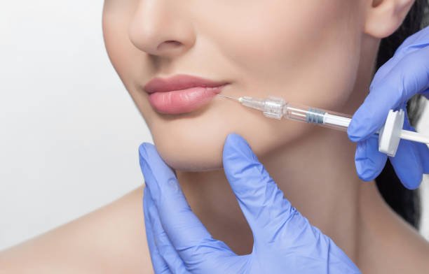 Russian Lip Fillers in Abu Dhabi