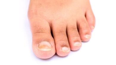 podiatrist and ingrown toenail