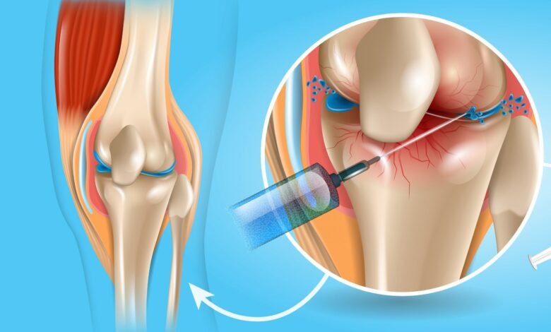 Osteoarthritis Therapeutics Market