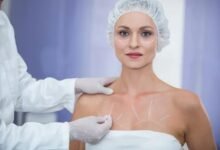 A woman undergoing breast surgery, preparing for her breast implant procedure in a clinical setting.