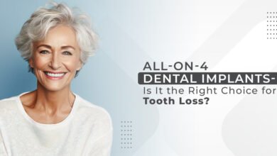 All-on-4 Dental Implants - Is it Right Choice for Tooth Loss