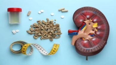 Can Kidney Stones Lead to Kidney Damage?