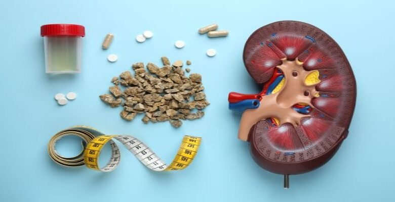 Can Kidney Stones Lead to Kidney Damage?