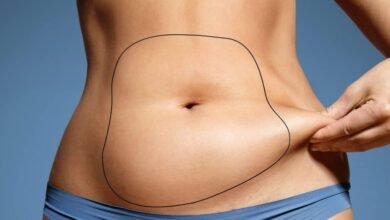 Liposuction in Dubai