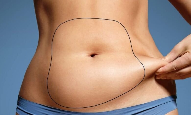 Liposuction in Dubai