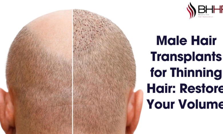 male hair transplant