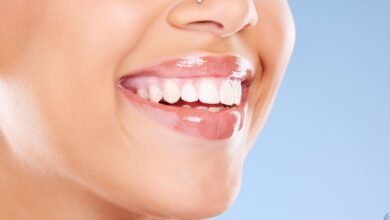 Teeth Whitening London