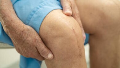 total knee replacement surgery