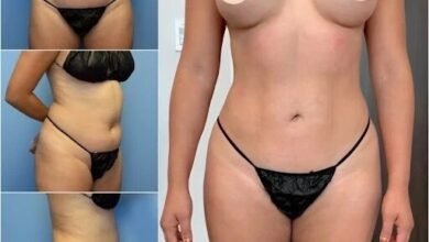 body contouring