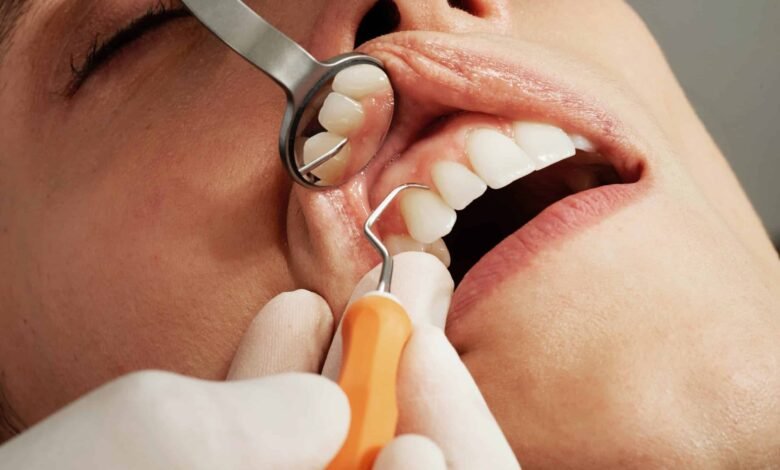 brown-spots-on-teeth