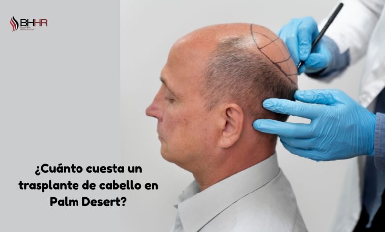 cuanto cuesta un trasplante de pelo