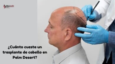 cuanto cuesta un trasplante de pelo