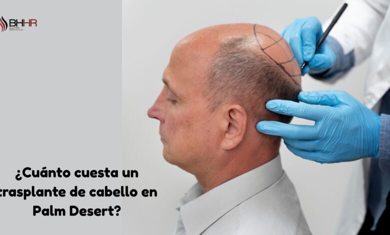 cuanto cuesta un trasplante de pelo